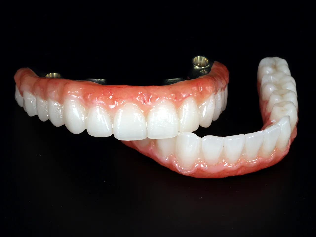Layered zirconia full-arch implant restoration with lifelike aesthetics by Prime Lab Dental Studios